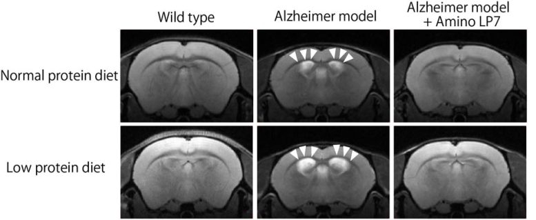 Effects of Amino LP7 and Diet on Brain Atrophy